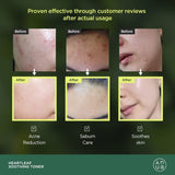 Anua Heartleaf 77% Soothing Toner 250ml - Palace Beauty