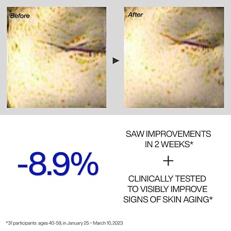 [IOPE] Retinol Expert 0.1% Serum Wrinkle Corrector (30ml)