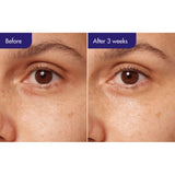 [IOPE] Retinol Expert 0.3% Serum Wrinkle Corrector (20ml)