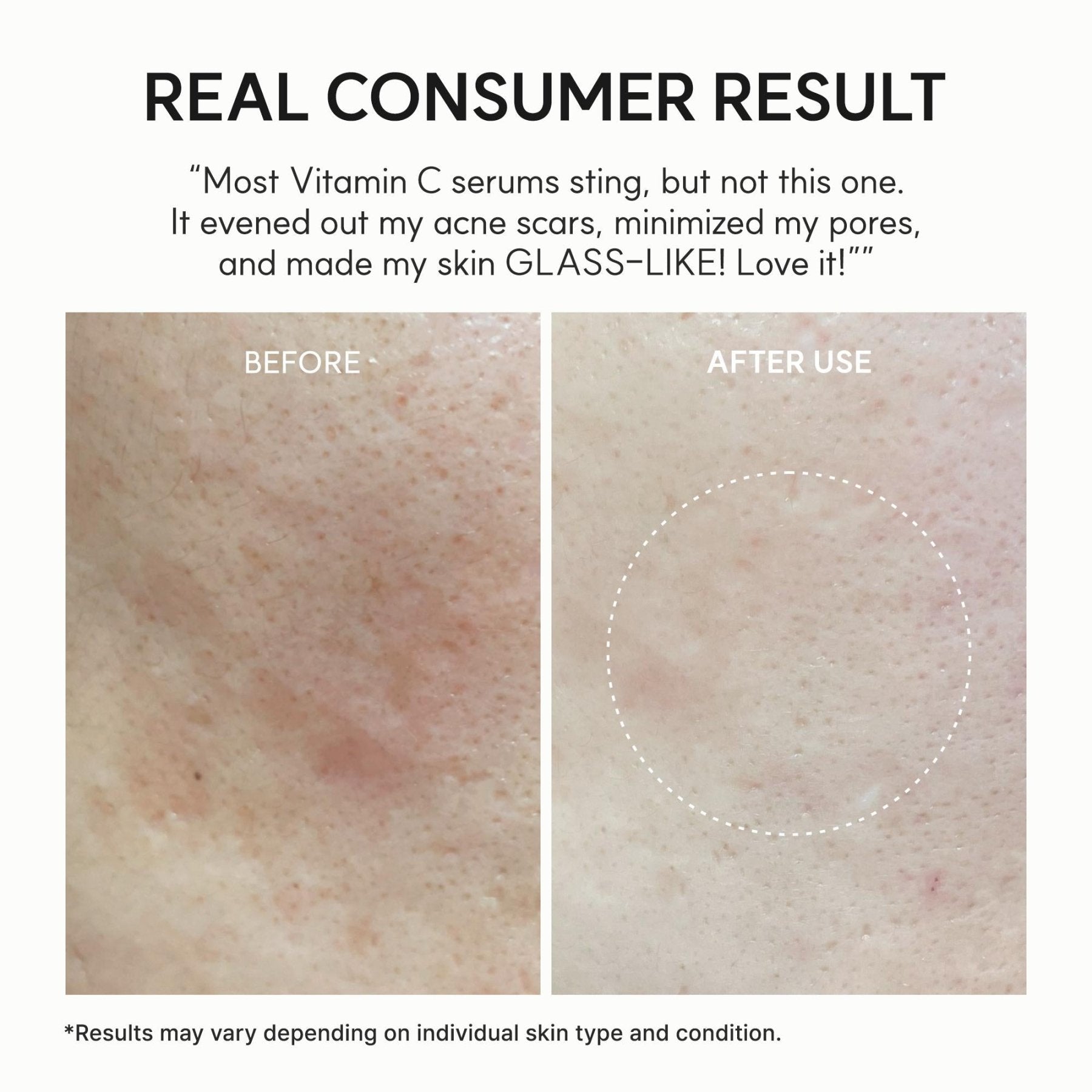 [Arencia] Vitamin C Booster Shot (30ml) - Palace Beauty