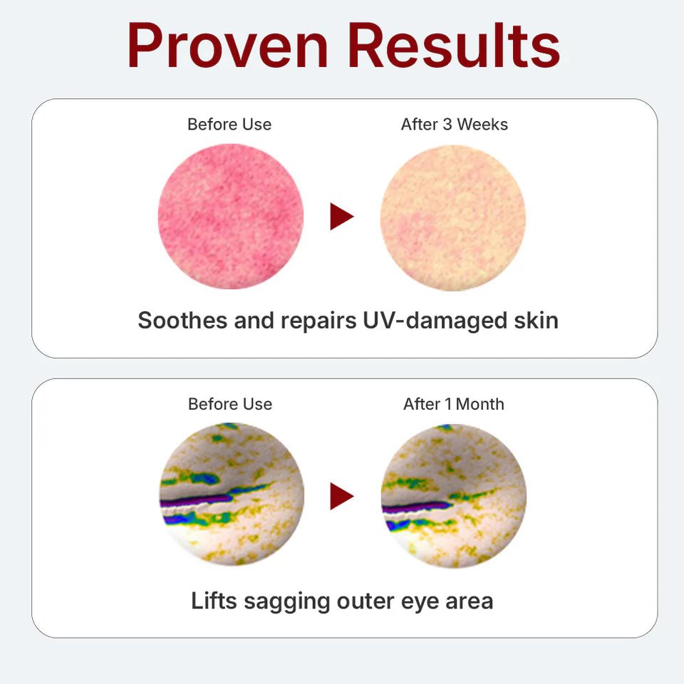 [Centellian24] Madeka Derma Mask Sheet III Intemsive Formula 100% cotton sheet (1pc or 1box(10pcs) - Palace Beauty