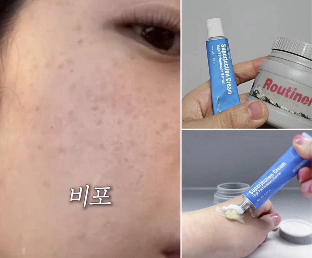 [Conapidil] Superjection Cream (20g/0.7oz) - Palace Beauty