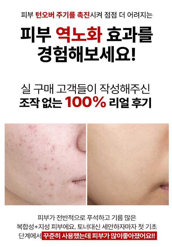 [DIFFER&DEEPER] Red Exsome Skin Booster Ampoule (2mlX14pcs) - Palace Beauty