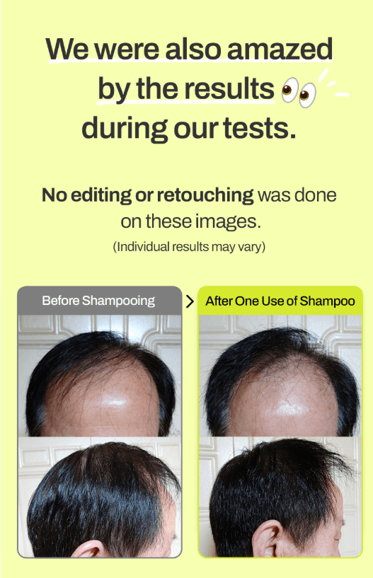 [grabity] Hair Lifting Shampoo Extra Strong Hair Loss care 475ml - Palace Beauty