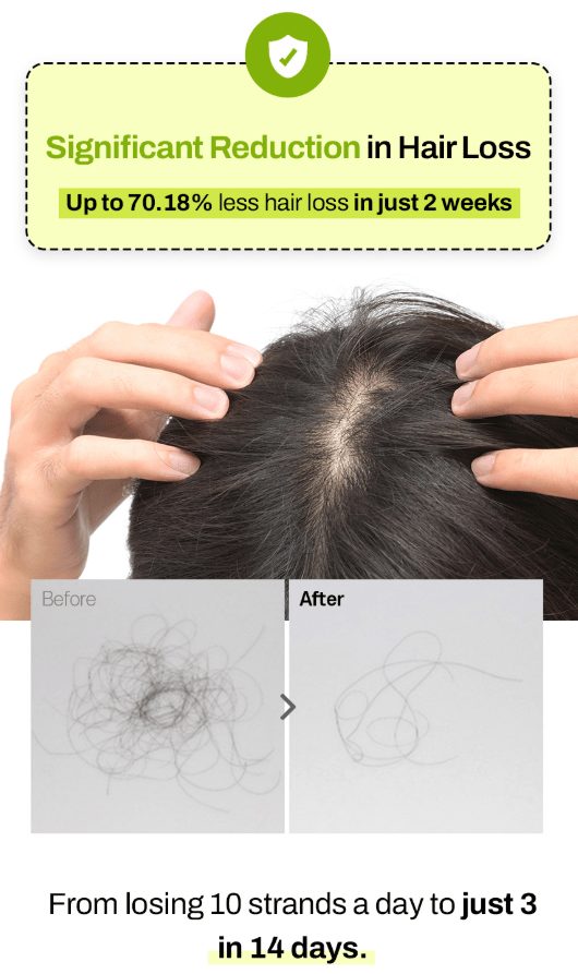 [grabity] Hair Lifting Shampoo Extra Strong Hair Loss care 475ml - Palace Beauty