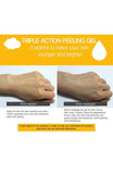 [IASO] Triple Action Peeling Gel - Palace Beauty