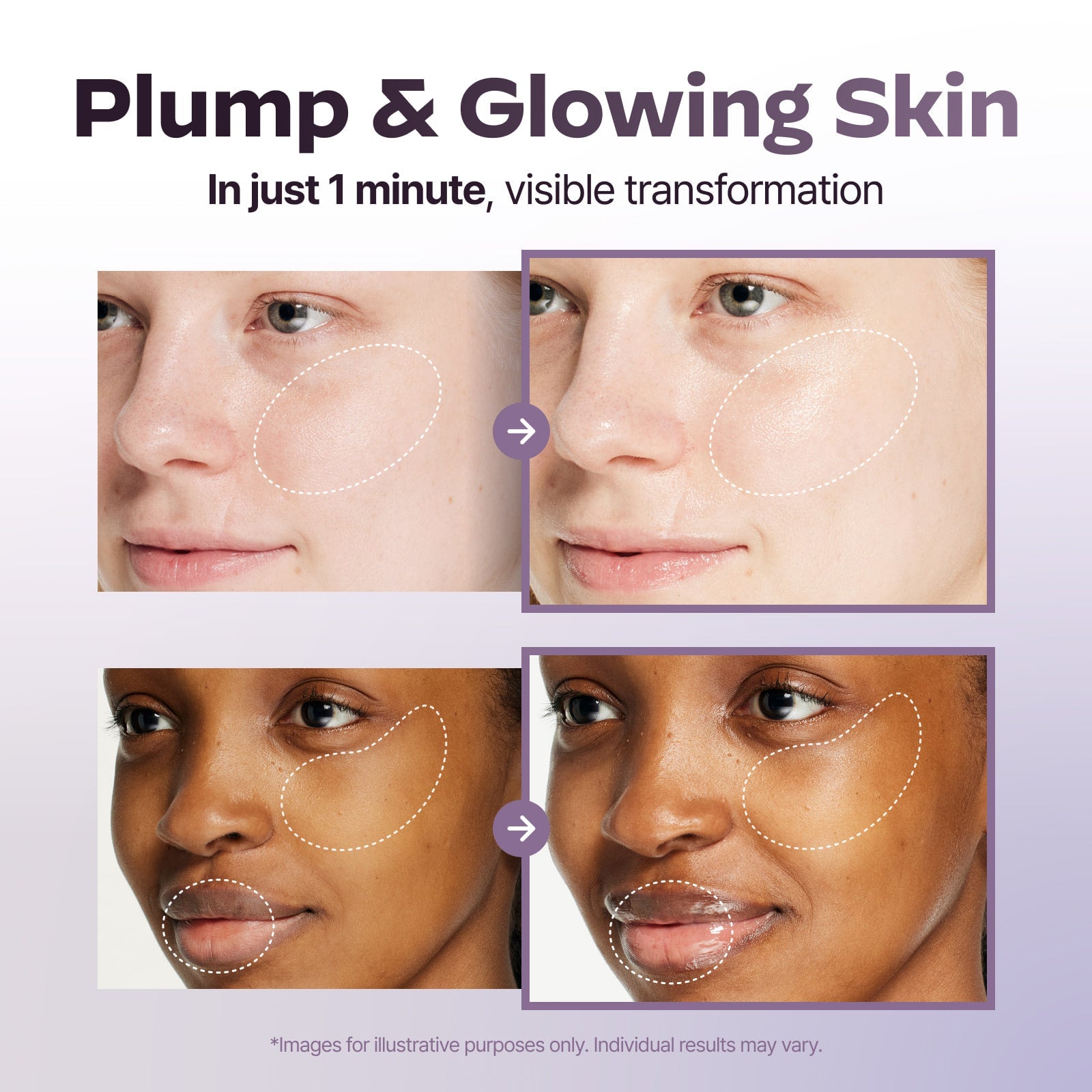 [LG Pra.L] SUPERFORM Galvanic Booster (Free Serum Gift) - Palace Beauty
