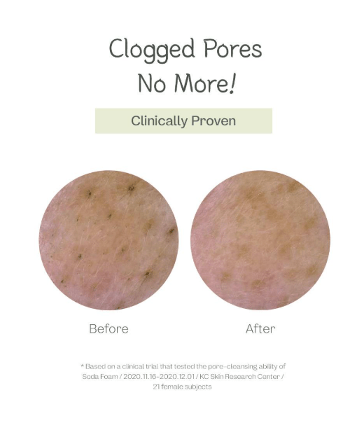 ma:nyo Deep Pore Cleansing Soda Foam 150ml - Palace Beauty