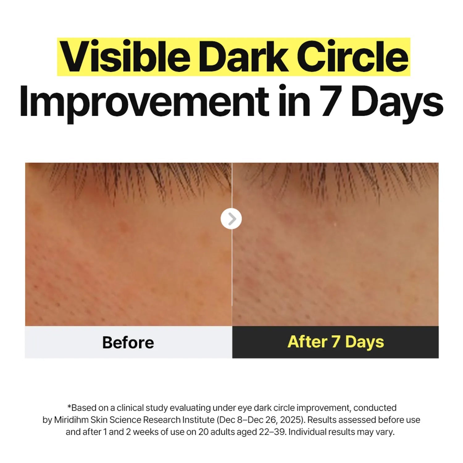 [manyo] Glutathione 7 Dark Spot Serum Patch 30P - Palace Beauty