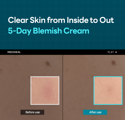 [MEDIHEAL] Madecassoside Derma Cream 50ml - Palace Beauty