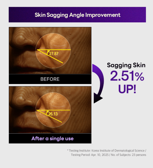 [MEDIHEAL] PDRN Lifting Serum 40ml - Palace Beauty