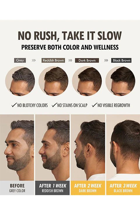 [MODAMODA] Zero Gray Black Shampoo 10 (300g/10.58fl.oz) - Palace Beauty