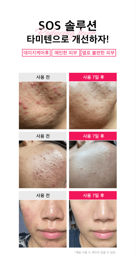 [NOTALY] Tamiten Toner (500ml/16.90fl.oz) - Palace Beauty