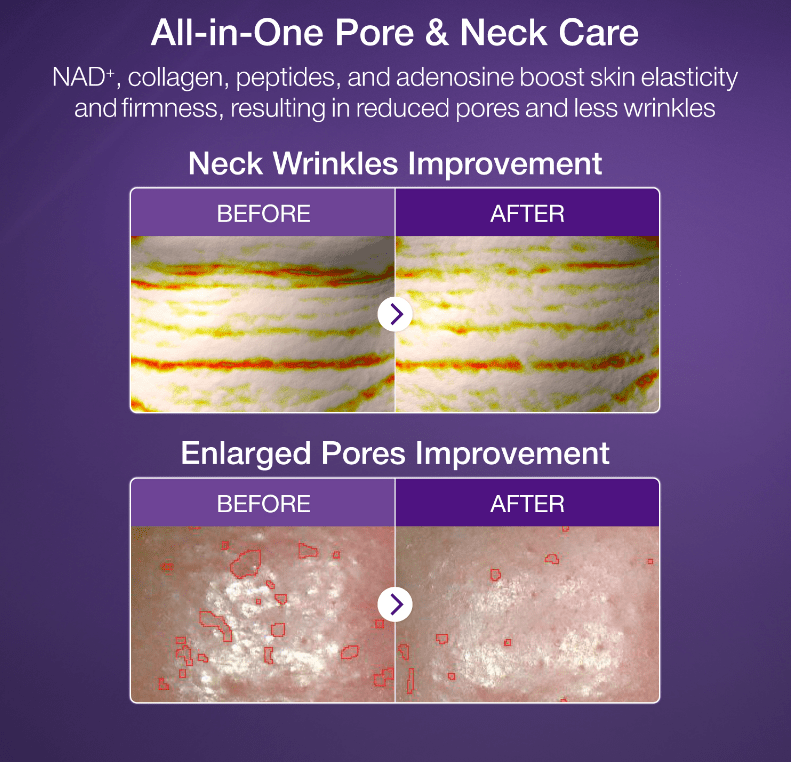 [numbuzin] No. 9 NAD Bio Lifting - sil Full Face Pack Sheet 4ea Set (+Fabric Lifting Band) - Palace Beauty