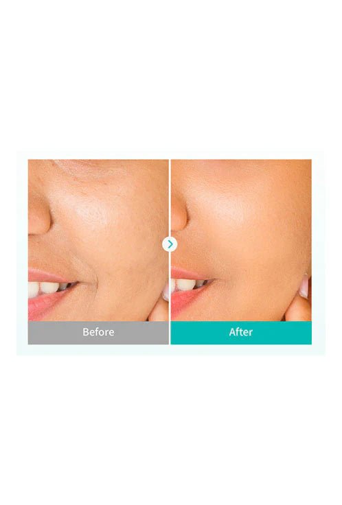 [REJURAN] Rebalancing Toner c - PDRN (120ml/4.05fl.oz) - Palace Beauty