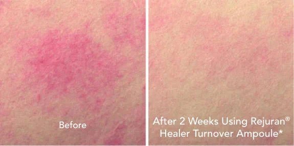 [REJURAN] Turnover Ampoule c - PDRN 0.5% (30ml) - Palace Beauty