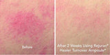 [REJURAN] Turnover Ampoule c - PDRN 0.5% (30ml) - Palace Beauty