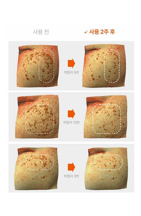 [Renk] Cell Brightening Blemish Serum (50ml/1.69fl.oz) - Palace Beauty