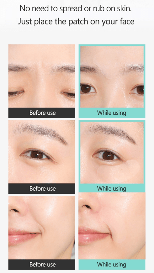 [RiRe] Smile Wrinkle Patch 1sheet(10patches) or 1box(5sheets/50patches) - Palace Beauty