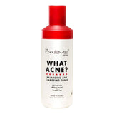 [The Creme Shop] What Acne? Balancing & Clarifying Toner (160ml) - Palace Beauty