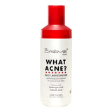 [The Creme Shop] What Acne? Daily Moisturizer (160ml) - Palace Beauty
