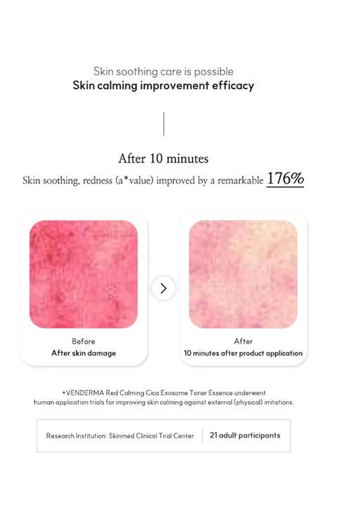 [VENDERMA] Red Calming Cica Exosome Toner Essence (150ml/5.07fl.oz) - Palace Beauty