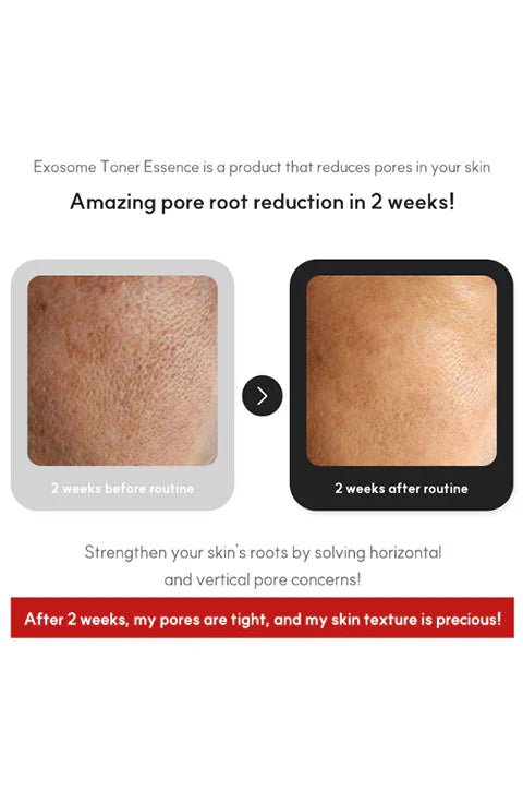 [VENDERMA] Red Calming Cica Exosome Toner Essence (150ml/5.07fl.oz) - Palace Beauty