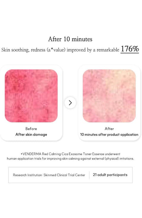 [VENDERMA] Red Calming Cica Exosome Toner Essence (150ml/5.07fl.oz) - Palace Beauty