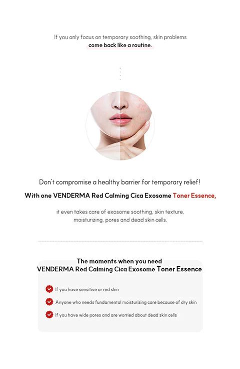 [VENDERMA] Red Calming Cica Exosome Toner Essence (150ml/5.07fl.oz) - Palace Beauty