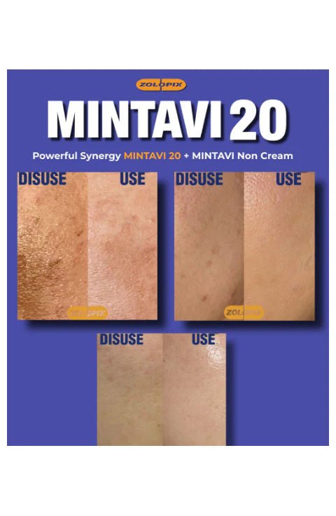 [ZOLOPIX] Mintavi Super Booster Kits - Palace Beauty